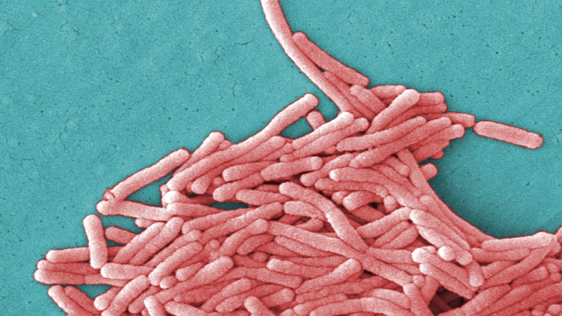 Legionella pneumophila