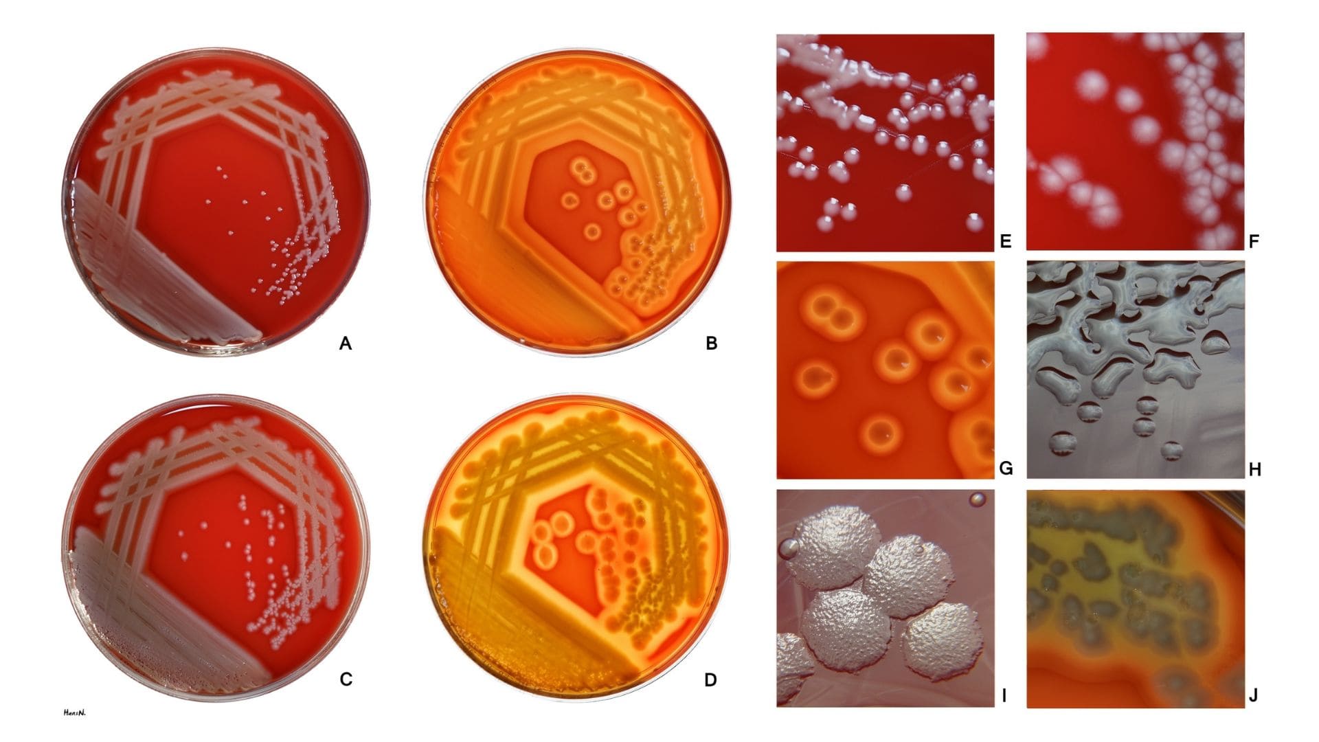Pseudomonas aeruginosa